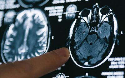 Pitt researchers publish Familial Alzheimer’s Disease study findings